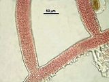 4 - Cellule corticali in visione superficiale